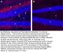 Cannabinoid Receptor 1 (ext) Blocking Peptide