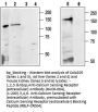 Calcium Sensing Rec (ext) Blockining Peptide