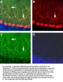 GluR2/GluA2 (extracellular) Blocking Peptide