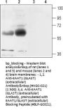 EAAT1/GLAST Blocking Peptide
