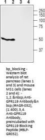 GPR119 Blocking Peptide