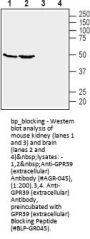 GPR39 Blocking Peptide