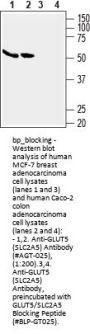 GLUT5/SLC2A5 Blocking Peptide