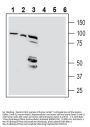 Beta 1 Na+/K+ ATPase (extracellular) Blocking Peptide