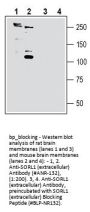 SORL1 (extracellular) Blocking Peptide