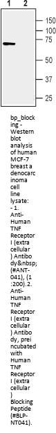 Human TNF Receptor I Blocking Peptide