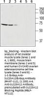 SLC25A12 Blocking Peptide