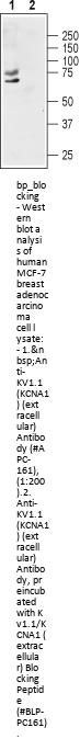Kv1.1/KCNA1 Blocking Peptide
