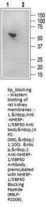 NHERF-1/EBP50 Blocking Peptide