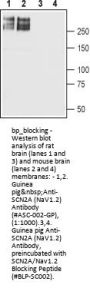 SCN2A/Nav1.2 Blocking Peptide