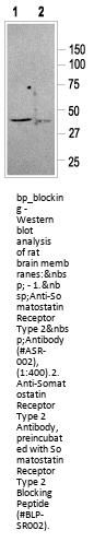 Somatostatin Receptor Type 2 Blocking Peptide