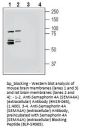 Semaphorin 4A (SEMA4A) (extracellular) Blocking Peptide