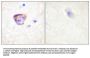 PYK2 Antibody