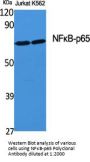 NFκB-p65 Antibody
