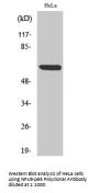 NFκB-p65 Antibody