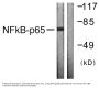 NFκB-p65 Antibody