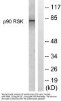 Rsk-1 Antibody