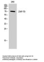 ZAP-70 Antibody