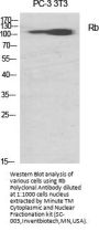 Rb Antibody