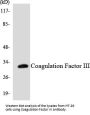 TF Antibody