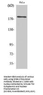 ErbB-3 Antibody