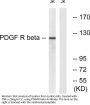 PDGFR-β Antibody