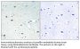 Rb Antibody