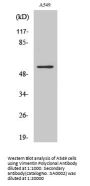 Vimentin Antibody