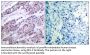 Bcl-2 Antibody