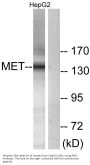 Met Antibody