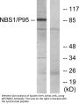 Nibrin Antibody