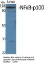 NFκB-p100 Antibody