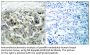 NFκB-p105 Antibody
