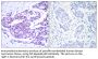 NFκB-p65 Antibody