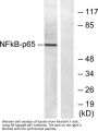 NFκB-p65 Antibody