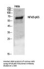 NFκB-p65 Antibody