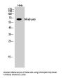 NFκB-p65 Antibody