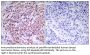 NFκB-p65 Antibody