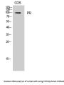 PR Antibody