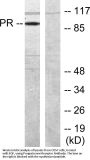 PR Antibody
