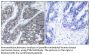 PYK2 Antibody