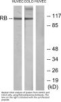 Rb Antibody
