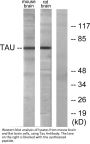 Tau Antibody