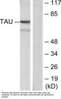 Tau Antibody