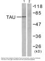 Tau Antibody