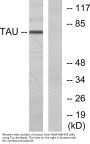 Tau Antibody