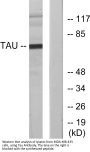 Tau Antibody