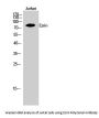 Ezrin Antibody
