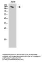 Rb Antibody