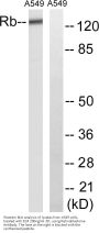 Rb Antibody